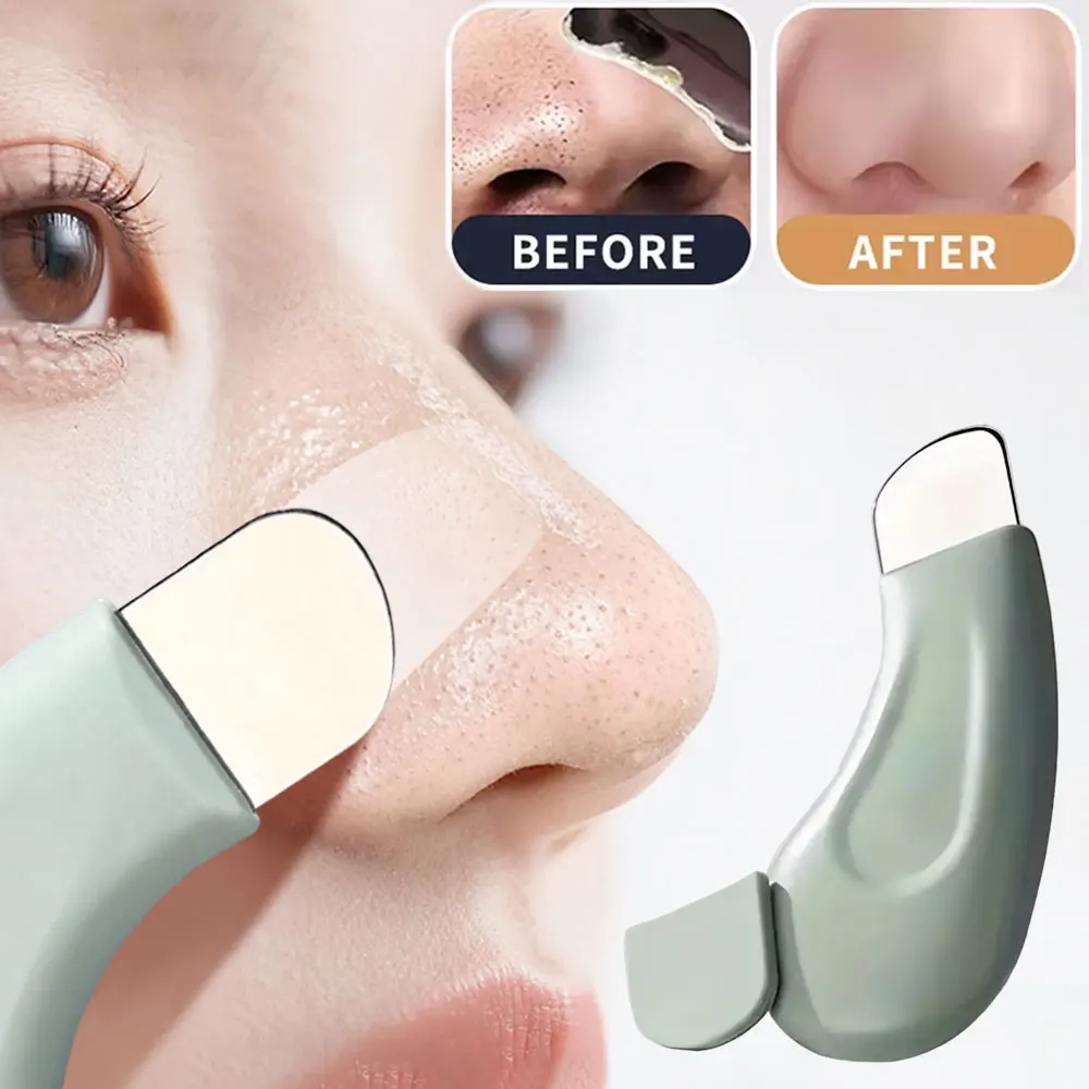 Nasal Aspirator - Hulpmiddel voor het verwijderen van mee-eters,